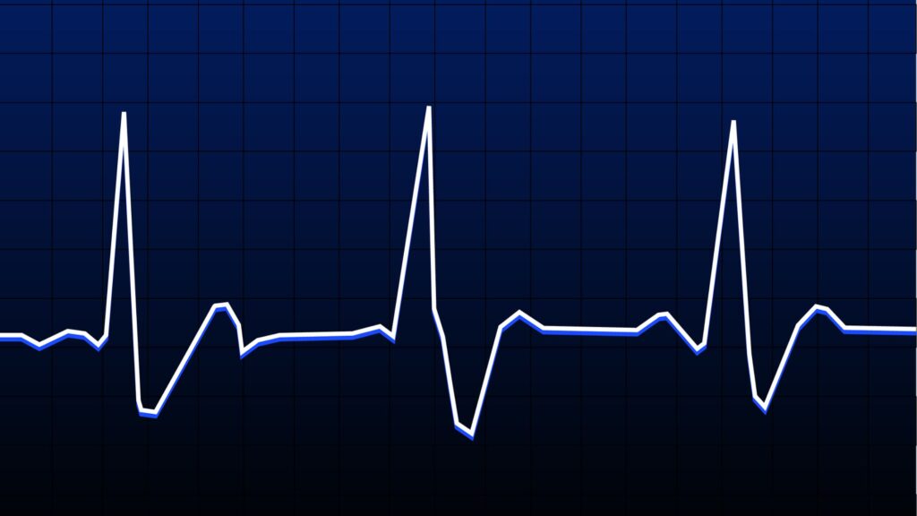 Image of blips on a heart rate monitor. For blog post of Brad Yanagida DNR